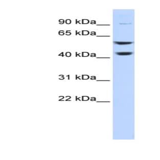 anti-ATPase, H+ Transporting, Lysosomal 56/58kDa, V1 Subunit B2 (ATP6V1B2) (Middle Region) antibody avatar