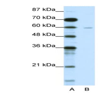 anti-DCP1 Decapping Enzyme Homolog A (S. Cerevisiae) (DCP1A) (N-Term) antibody avatar
