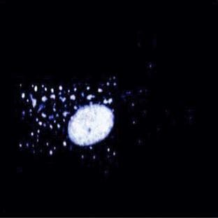 anti-Matrix Metalloproteinase 4 (MMP4) (AA 592-695) antibody avatar
