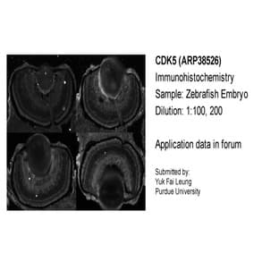 anti-Cyclin-Dependent Kinase 5 (CDK5) (C-Term) antibody avatar