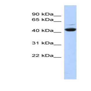 anti-ATPase, H+ Transporting, Lysosomal 42kDa, V1 Subunit C1 (ATP6V1C1) (N-Term) antibody avatar