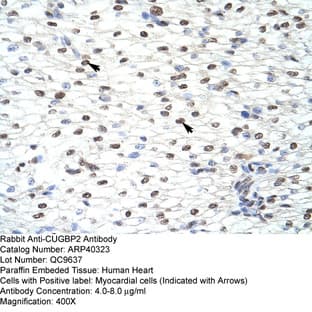 anti-CUGBP, Elav-Like Family Member 2 (CELF2) (N-Term) antibody avatar