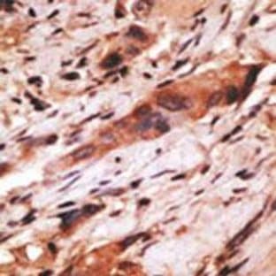 anti-CD82 Molecule (CD82) (C-Term) antibody avatar