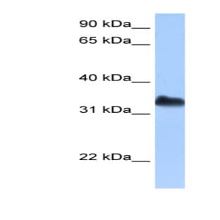 anti-Dead End Homolog 1 (Zebrafish) (DND1) (C-Term) antibody avatar