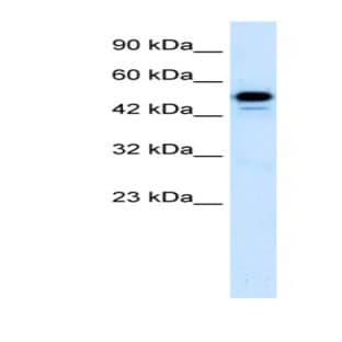 anti-Cyclin-Dependent Kinase 8 (CDK8) (C-Term) antibody avatar