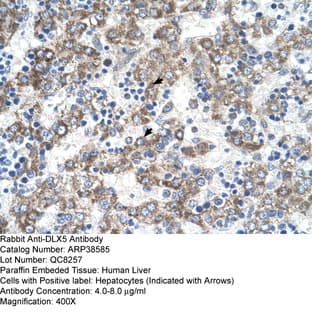 anti-Distal-Less Homeobox 5 (DLX5) (N-Term) antibody