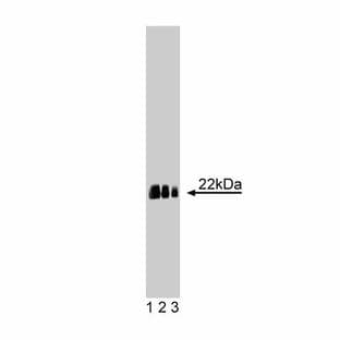 anti-Caveolin 1, Caveolae Protein, 22kDa (CAV1) (AA 1-178) antibody avatar