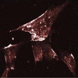 anti-Caveolin 1, Caveolae Protein, 22kDa (CAV1) (AA 1-178) antibody avatar