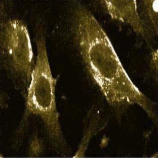 anti-Caveolin 1, Caveolae Protein, 22kDa (CAV1) (AA 1-178) antibody avatar