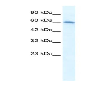 anti-Cholinergic Receptor, Nicotinic, alpha 7 (Neuronal) (CHRNA7) (Middle Region) antibody avatar