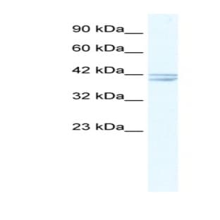 anti-Cholinergic Receptor, Nicotinic, alpha 7 (Neuronal) (CHRNA7) (N-Term) antibody avatar