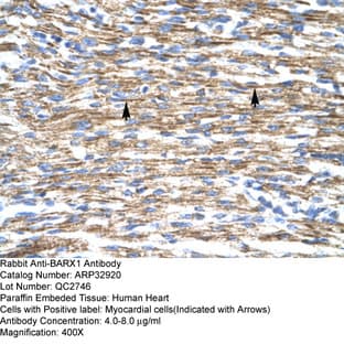 anti-BARX Homeobox 1 (BARX1) (Middle Region) antibody