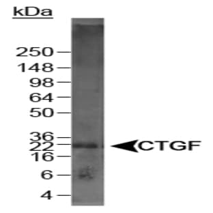 anti-Connective Tissue Growth Factor (CTGF) (C-Term), (AA 299-349) antibody avatar