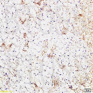 anti-Connective Tissue Growth Factor (CTGF) (C-Term) antibody avatar