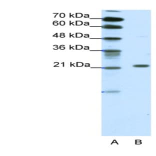 anti-Chromobox Homolog 1 (CBX1) (Middle Region) antibody avatar