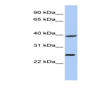 anti-Chromosome 12 Open Reading Frame 42 (C12orf42) (N-Term) antibody avatar