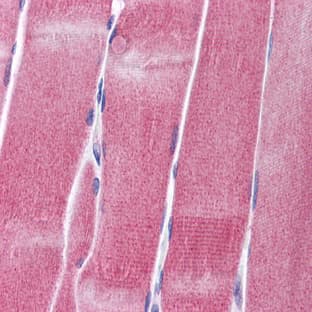 anti-Potassium Voltage-Gated Channel, Shaw-Related Subfamily, Member 4 (KCNC4) (Middle Region) antibody avatar