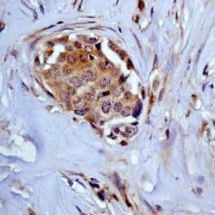 anti-ADP-Ribosylation Factor 1 (ARF1) antibody avatar