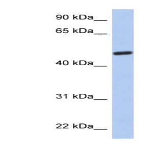 anti-Chromosome 2 Open Reading Frame 62 (C2orf62) (N-Term) antibody avatar