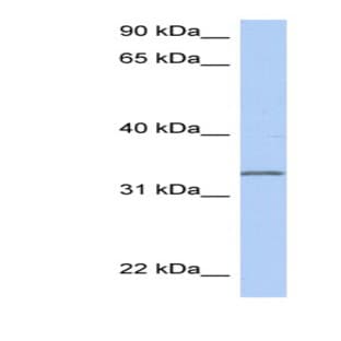 anti-Chromosome 3 Open Reading Frame 62 (C3orf62) (Middle Region) antibody avatar