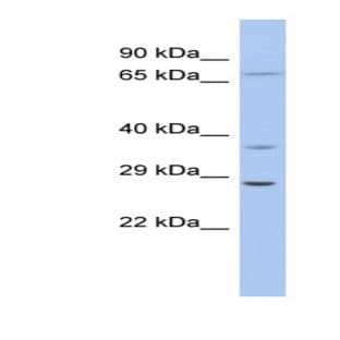 anti-Achaete-Scute Complex Homolog 1 (Drosophila) (ASCL1) (Middle Region) antibody avatar