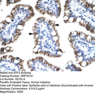 anti-Activating Transcription Factor 2 (ATF2) (C-Term) antibody avatar