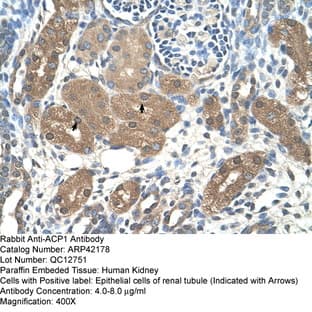 anti-Acid Phosphatase 1, Soluble (ACP1) (N-Term) antibody avatar