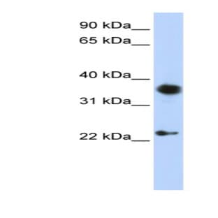 anti-Engrailed 1 (EN1) (C-Term) antibody avatar