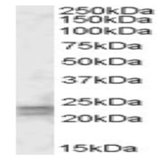 anti-ADP-Ribosylation Factor-Like 4D (ARL4D) (Internal Region) antibody avatar
