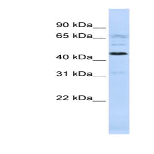 anti-Chromosome 22 Open Reading Frame 9 (C22orf9) (Middle Region) antibody avatar