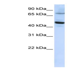 anti-Cytochrome P450, Family 46, Subfamily A, Polypeptide 1 (CYP46A1) (C-Term) antibody avatar