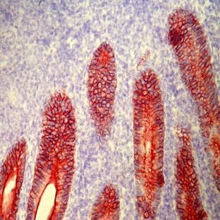 anti-Cytokeratin 1 (KRT1) (pan) antibody avatar