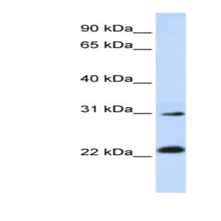 anti-Adaptor-Related Protein Complex 3, sigma 1 Subunit (AP3S1) (N-Term) antibody avatar