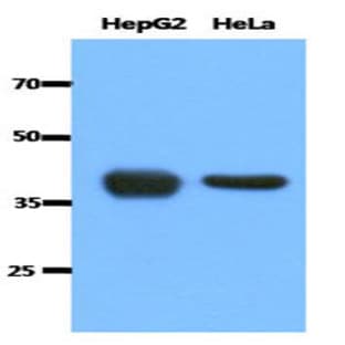 anti-Acetyl-CoA Acetyltransferase 1 (ACAT1) (AA 34-427) antibody avatar