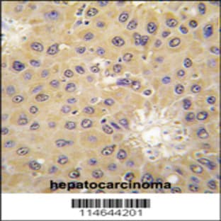 anti-Acetyl-CoA Acetyltransferase 1 (ACAT1) (C-Term), (AA 296-329) antibody avatar