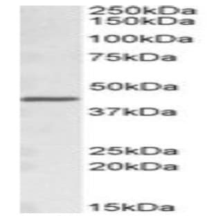 anti-Acetyl-CoA Acetyltransferase 1 (ACAT1) (Internal Region), (AA 253-266) antibody avatar