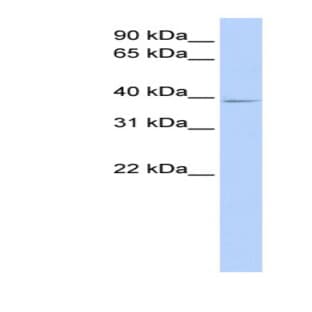 anti-Chromosome 18 Open Reading Frame 25 (C18ORF25) (Middle Region) antibody avatar