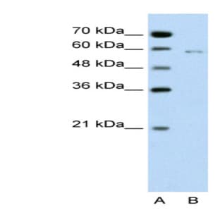 anti-Cell Division Cycle 23 Homolog (S. Cerevisiae) (CDC23) (C-Term) antibody avatar
