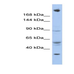 anti-Chromodomain Helicase DNA Binding Protein 4 (CHD4) (N-Term) antibody avatar