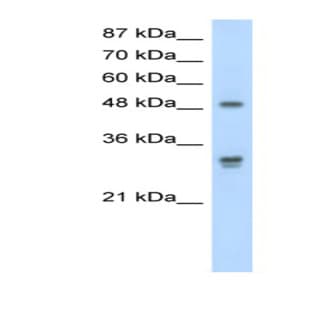 anti-DEAD (Asp-Glu-Ala-As) Box Polypeptide 19B (DDX19B) (C-Term) antibody avatar