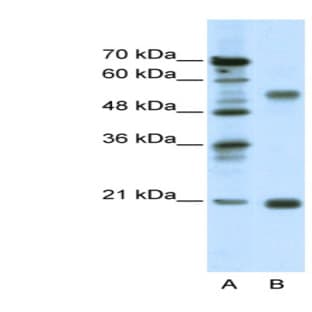 anti-Cholinergic Receptor, Nicotinic, beta 3 (Neuronal) (CHRNB3) (Middle Region) antibody avatar