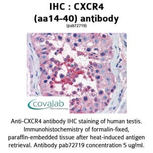 anti-Chemokine (C-X-C Motif) Receptor 4 (CXCR4) (N-Term), (Extracellular Domain), (AA 14-40) antibody avatar