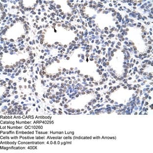 anti-Cysteinyl-tRNA Synthetase (CARS) (C-Term) antibody avatar