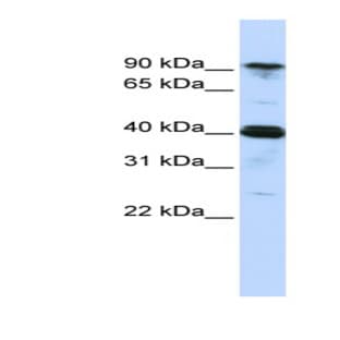 anti-Cysteinyl-tRNA Synthetase (CARS) (Middle Region) antibody avatar