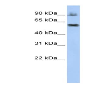 anti-Activating Signal Cointegrator 1 Complex Subunit 2 (ASCC2) (Middle Region) antibody avatar
