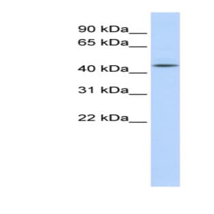 anti-Adenosylhomocysteinase (AHCY) (N-Term) antibody avatar