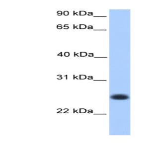 anti-Chromosome 12 Open Reading Frame 68 (C12orf68) (Middle Region) antibody avatar