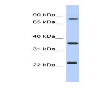 anti-Chromosome 17 Open Reading Frame 82 (C17orf82) (N-Term) antibody avatar