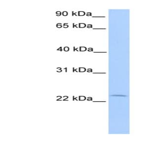anti-Chromosome 5 Open Reading Frame 39 (C5orf39) (N-Term) antibody avatar