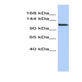 anti-AF4/FMR2 Family, Member 3 (AFF3) (Middle Region) antibody avatar